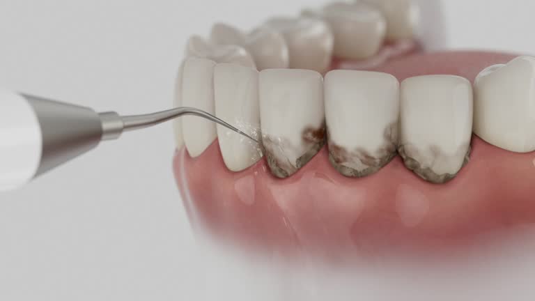 Reliable Dental Implants contractor in Chittenango, NY by Smile Center Dentistry